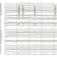 Image for article titled Why we have brain farts, and what scientists are doing to stop them